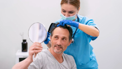 Hair Transplant Istanbul: Your Guide to the Best Hair Transplant in Turkey